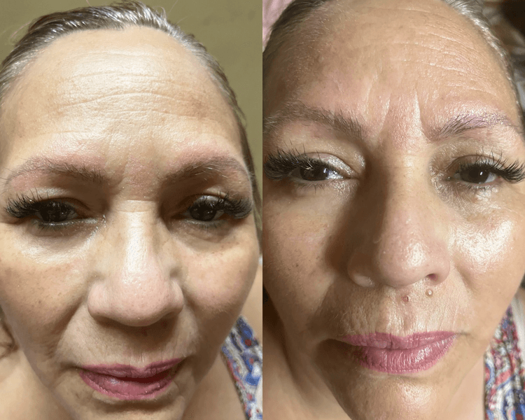 Limpieza Facial (Básica) + Drenaje Linfático Facial