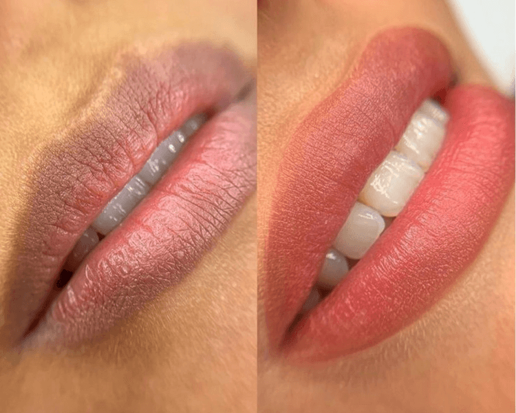 Hidralips con Ácido Hialurónico + Pigmentación