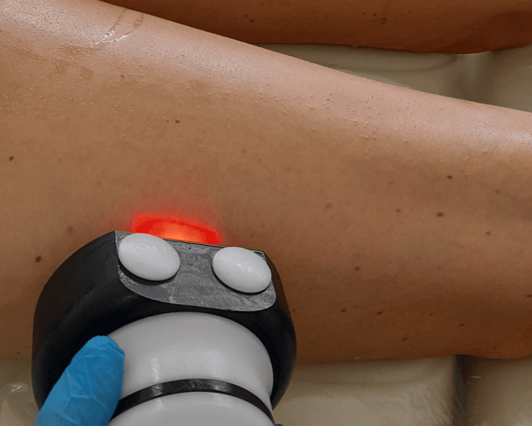 Vela Slim Plus muslos