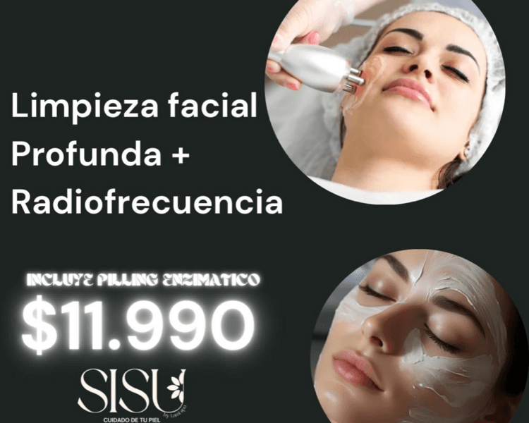 Marzo- Limpieza facial Profunda + Radiofrecuencia ( 1 sesion )