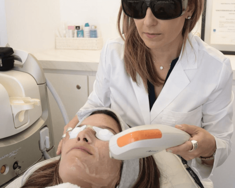 Laser Erbium Capilar