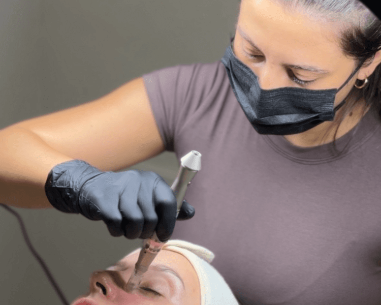 Microneedling + Hydra Lips