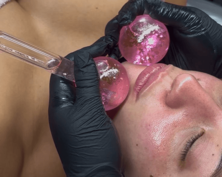 Limpieza Facial Profunda