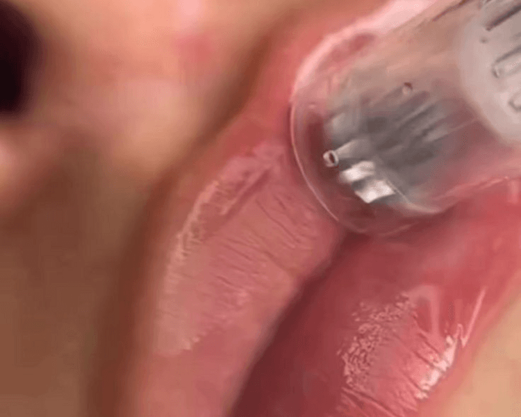 Hidra Lips (Hidratación Profunda)