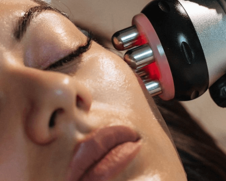 Full Lineas de Expresión/Arrugas (Dermaplaning+Peeling+Radiofrecuencia)