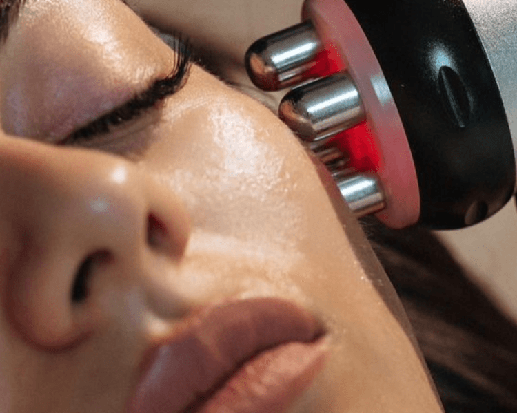 Inducción Pro-Colágeno Dual (Radiofrecuencia+Microneedling)
