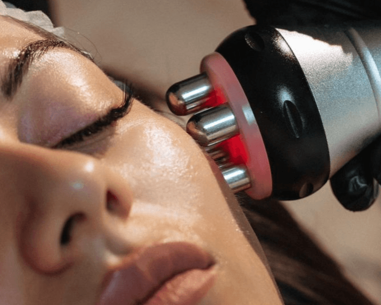 Sesión de Radiofrecuencia