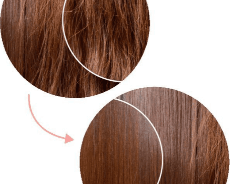 Cirugía Capilar de Truss Promo