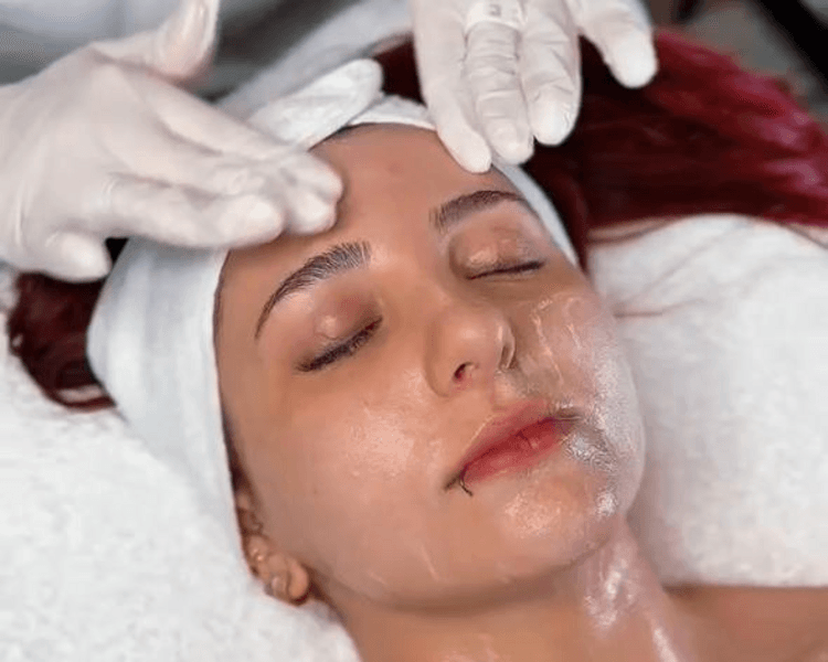 Skin Balance - tratamiento para acne