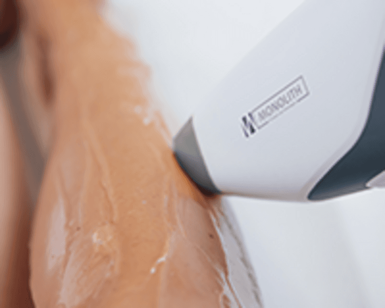 Depilación medias piernas