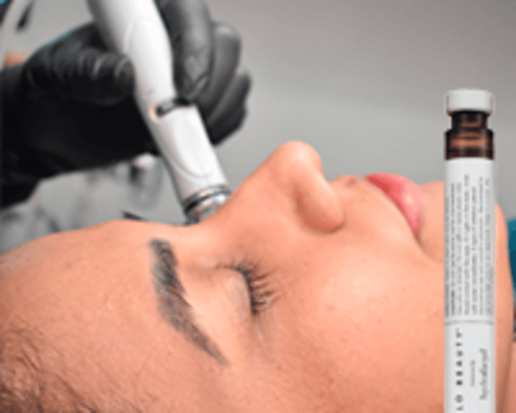 Hydrafacial JLO Beauty