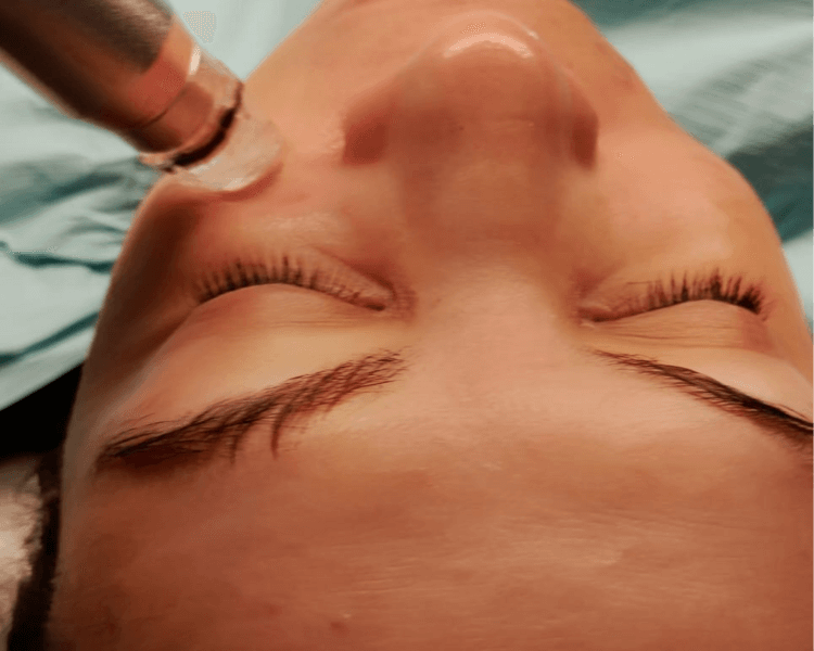 Limpieza facial básica