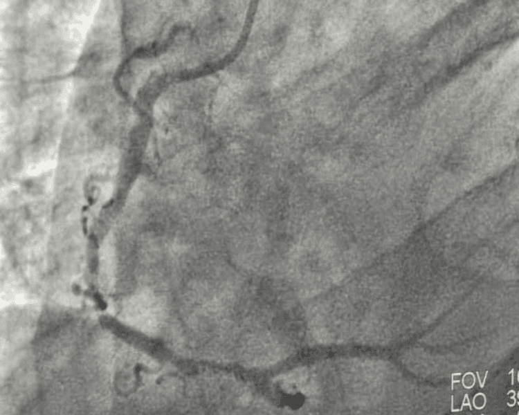 Cardiología Clínica e Intervencionista