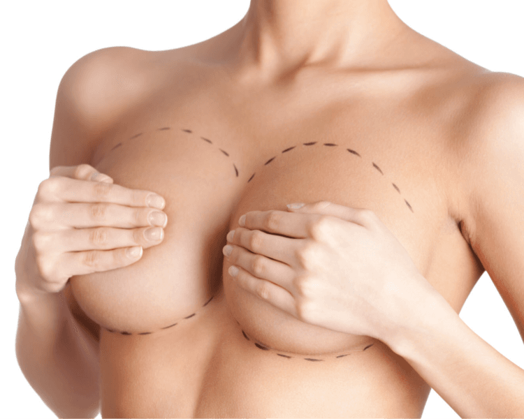 Post-Operatorio Mamoplastia