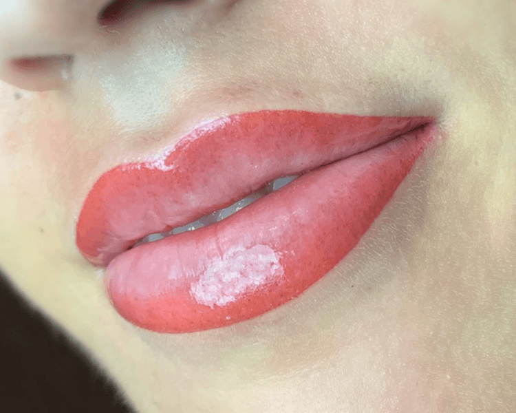 Contorno labios