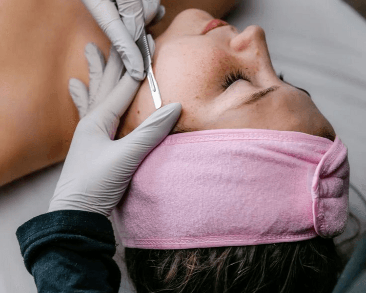 Tratamiento con Dermaplaning