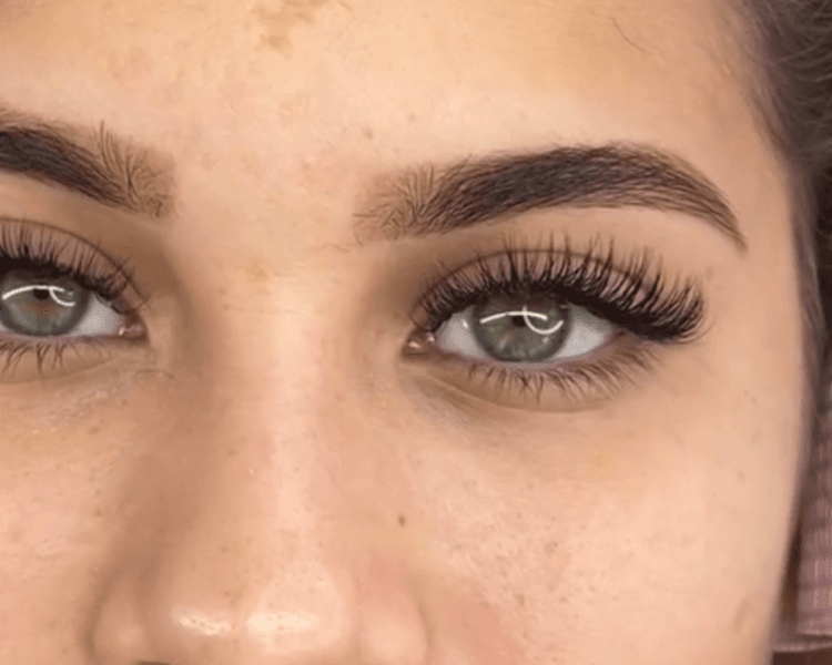 Extensiones Clásicas