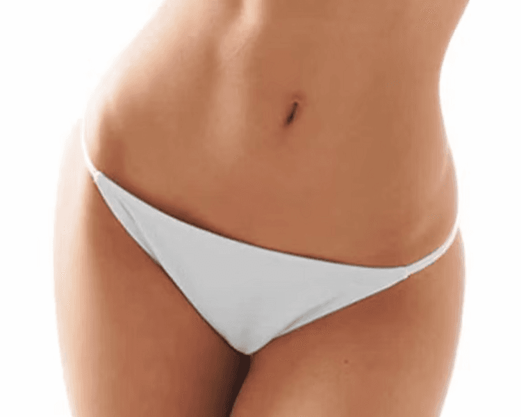 Paquete Depilacion Laser Diodo Axila Bikini Sencillo