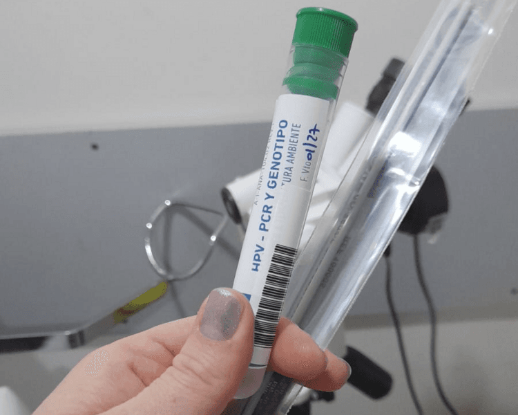 PAP & COLPO + TEST HPV