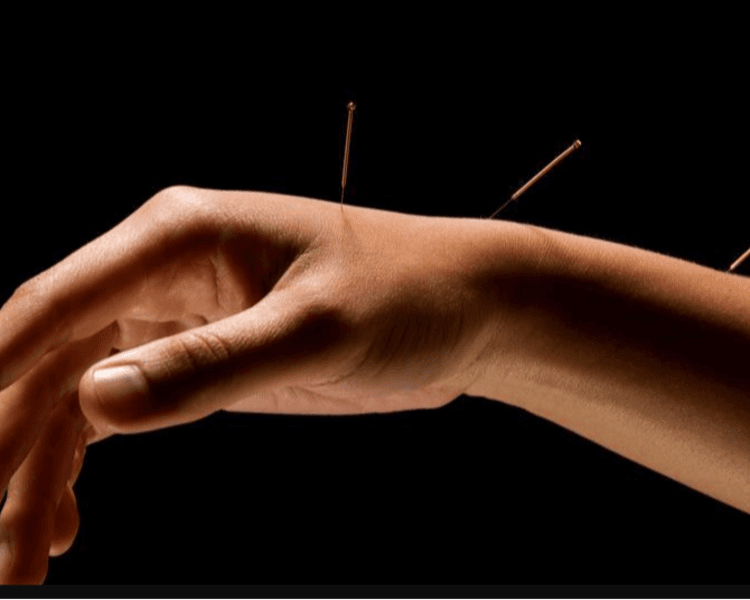 Tratamiento Acupuntura NeoClasica