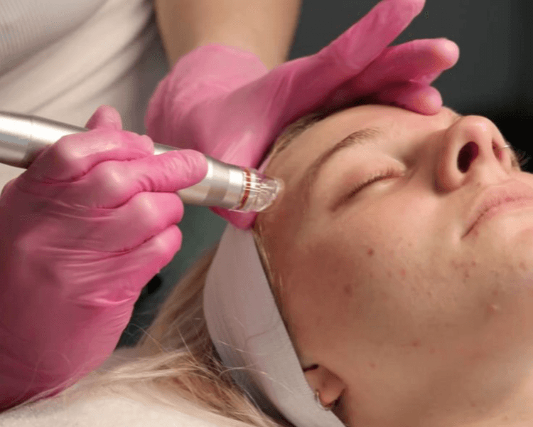 Facial de Renovación