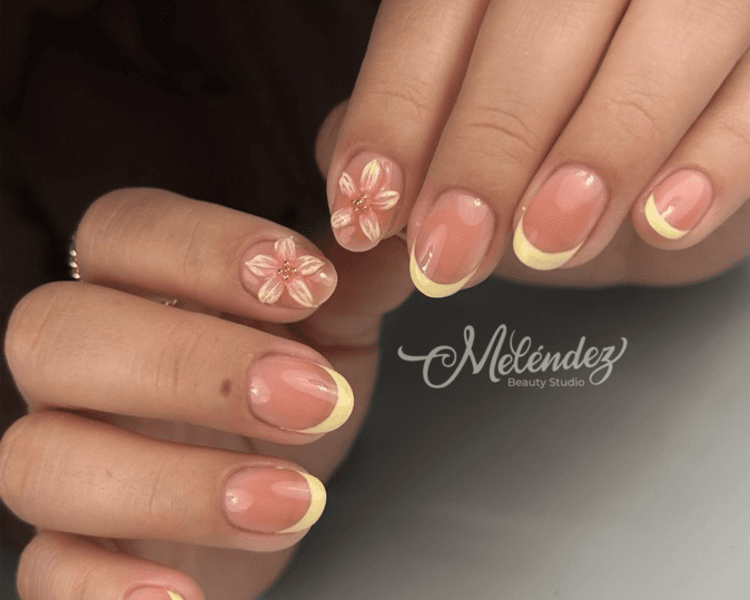 Kapping con diseño elaborado