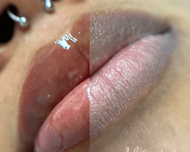 Neutralización de labios