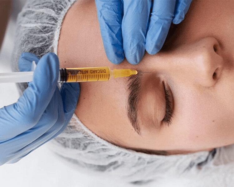 Plasma rico en plaquetas (rostro)