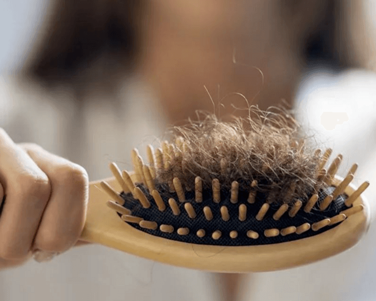 Consulta médica por caída del cabello