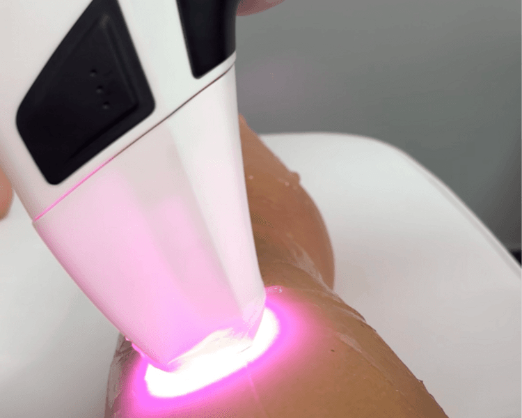 Evaluación y Sesión Depilación Definitiva