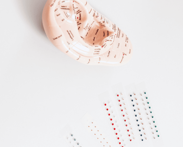 Pack de 5 sesiones de Auriculoterapia