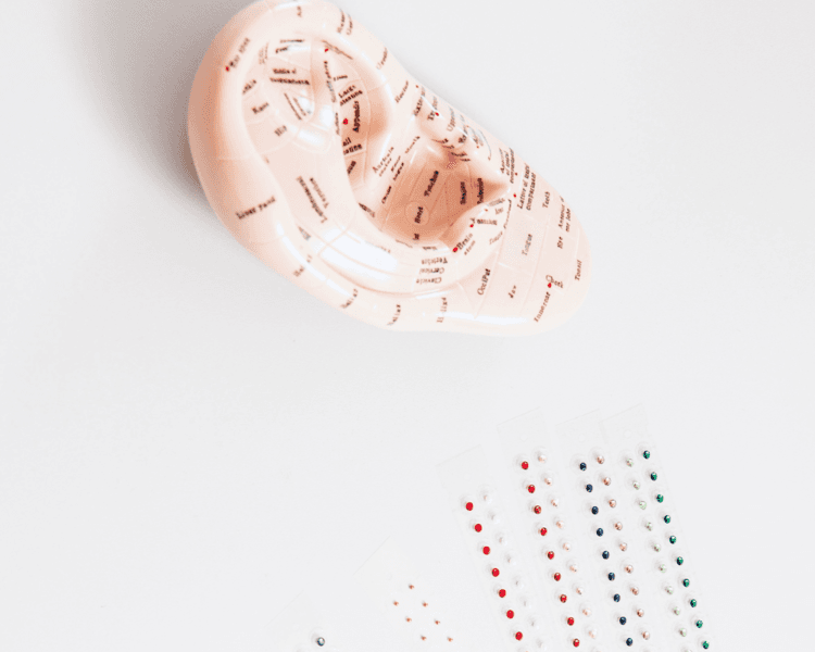 Pack de 10 sesiones de Auriculoterapia