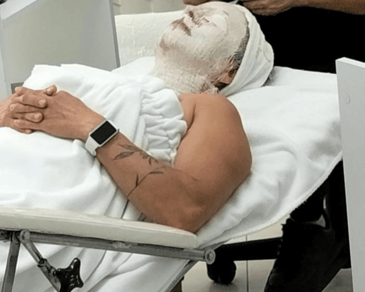 TRATAMIENTO IDEAL PIEL MADURA HIDROTENSOR CON RADIOFRECUENCIA Y GIMNASIA PASIVA