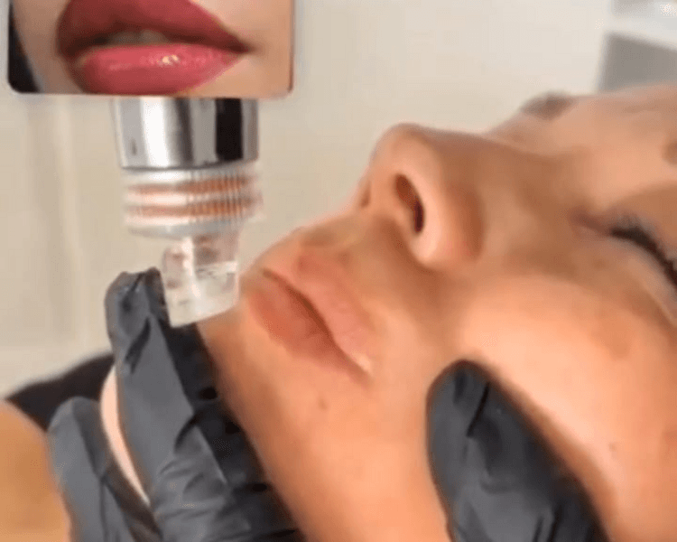 TRATAMIENTO DE HIDRATACION 6 EN 1