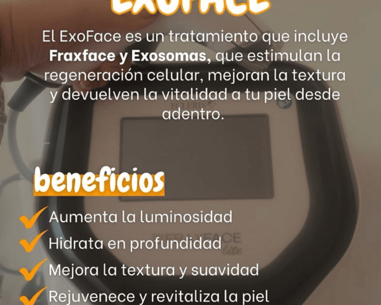 EXOFACE DAY JORNADA ESPECIAL