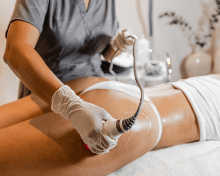 TRATAMIENTO ANTICELULITICO X10