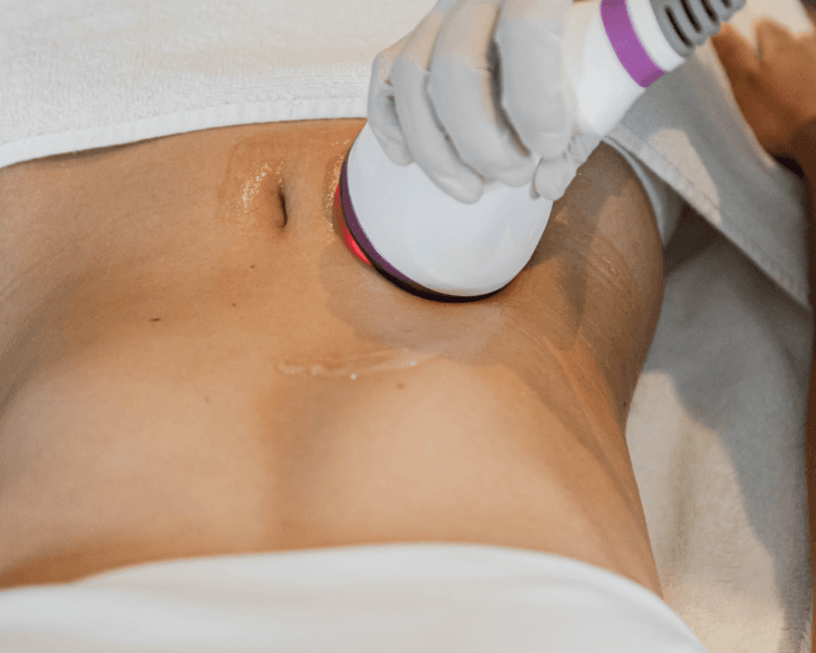 TRATAMIENTO REDUCTIVO X10