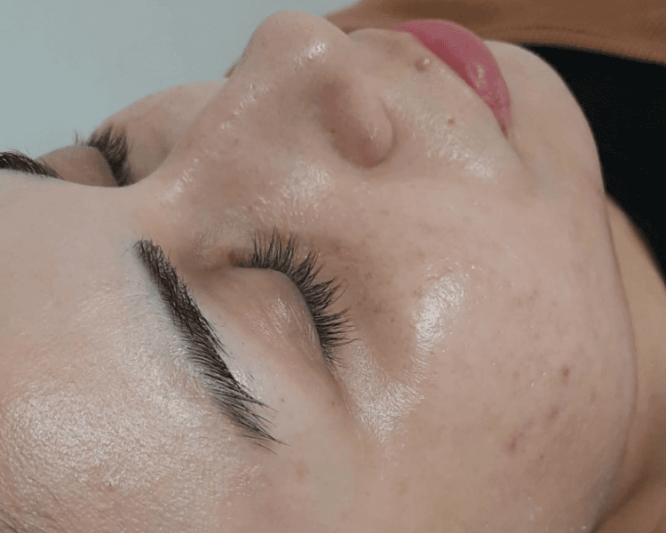 Sesión Inicial Rejuvenecimiento, Firmeza y Retraso de Envejecimiento Cutáneo