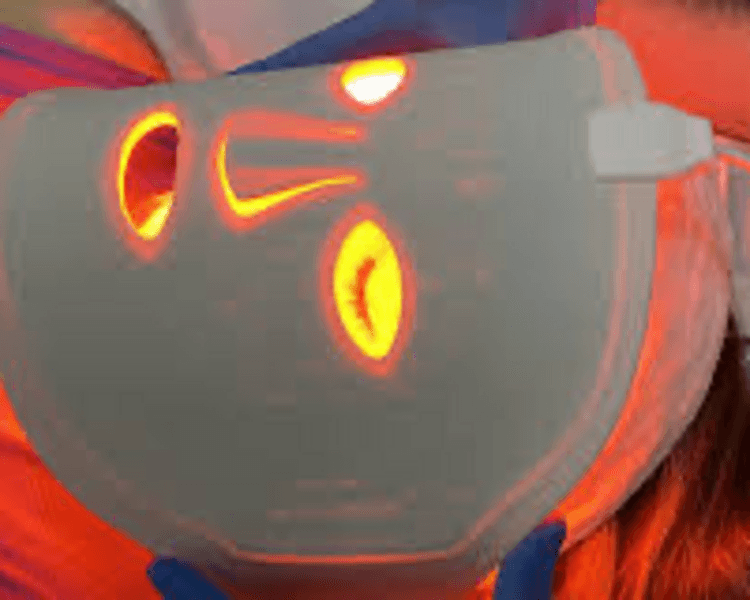 Photoage (terapia fotobiodinámica)