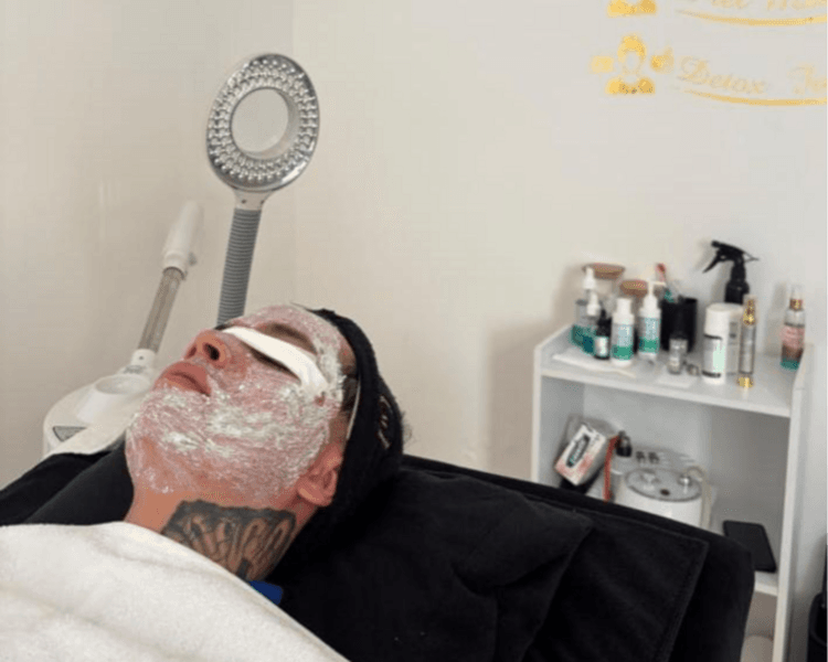 TRATAMIENTO FACIAL PARA PIEL CON ACNE