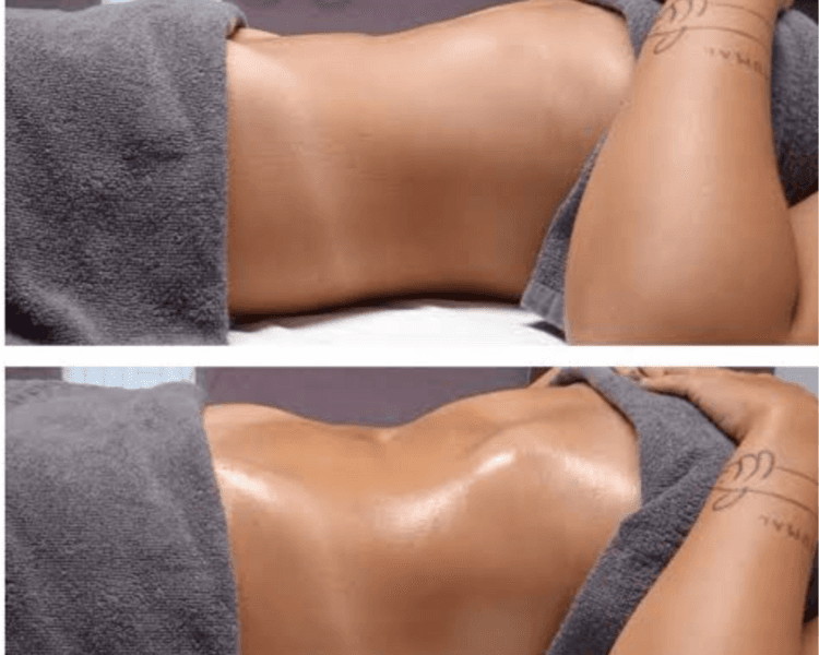 MASAJE REDUCTIVO TECNICA DIAMANTE