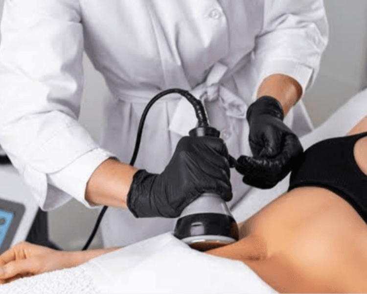 TRATAMIENTO PARA CELULITIS EN PIERNAS Y ABDOMEN