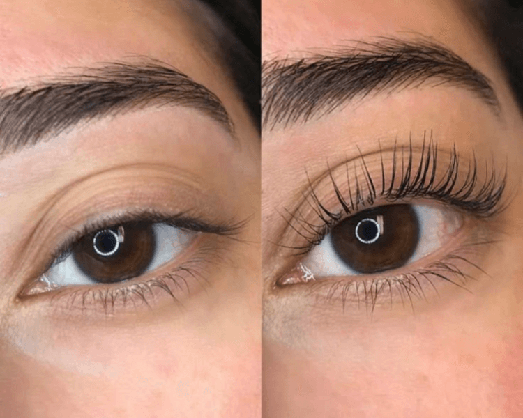 LIFTING DE PESTAÑAS (CON TINTE Y BOTOX)