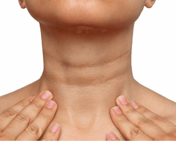 Despigmentante Corporal (1 Zona)