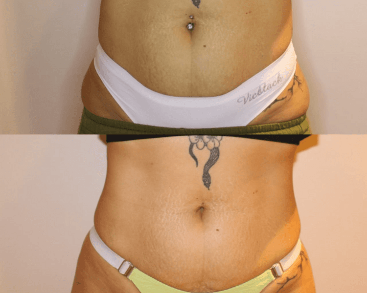 Plan Unique -40%off 1 zona por 8 sesiones