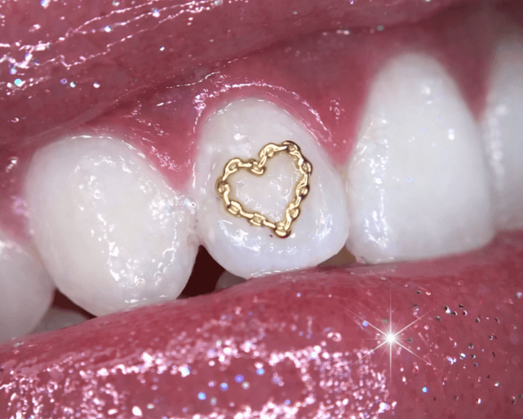 Extra Accesorio de Oro 18K✨