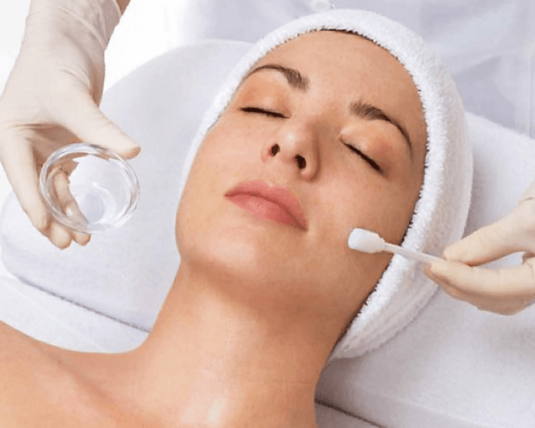 PEELINGS QUÍMICOS MÉDICOS