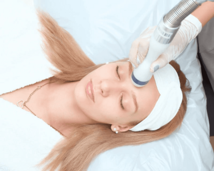 CRIO-RADIOFRECUENCIA