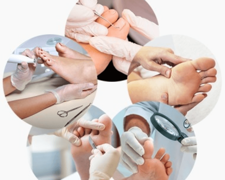 Promoción Pack 3 Sesiones de Podología