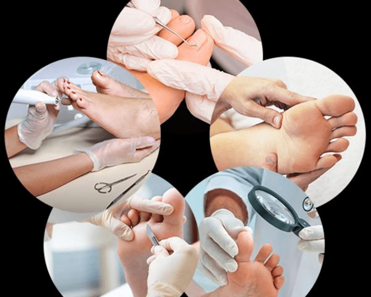 Promo 3 Sesiones de Podología Clínica